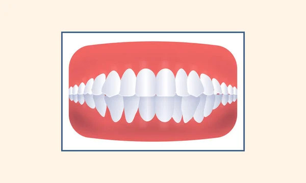 Crowding Human Teeth Icon Yellow Background — Stock Vector