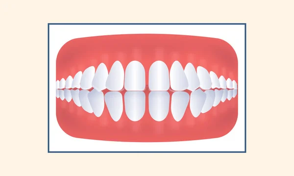 Icône Dents Espacement Excessif Sur Fond Jaune — Image vectorielle