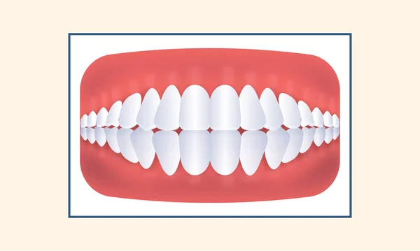 黄色の背景に通常の歯顎のアイコン — ストックベクタ