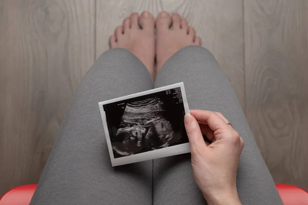 Schwangere Und Untersucht Ultraschallbilder Sitzt Auf Stuhl Draufsicht Schwangerschaftskonzept — Stockfoto