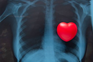 Red heart on x ray chest. Medical Concept clipart