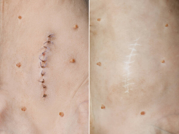 Хирургический шов после операции или кастрации и шрам после восстановления. Кошачья кожа крупного плана