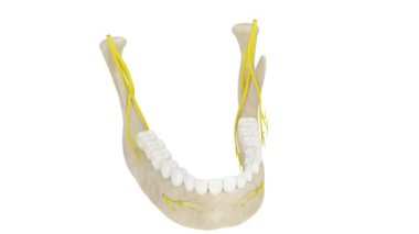 Sinirleri olan 360 derecelik çene kemeri görüntüsü