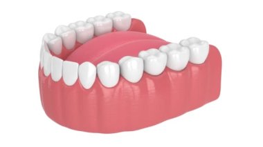 Human jaw with peri implantitis disease over white background