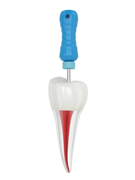Render Premolar Tooth Endodontic File White Background Endodontic Treatment Concept — Stock Photo, Image