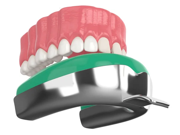 Render Upper Jaw Dental Impression Tray White Background — Stock Photo, Image