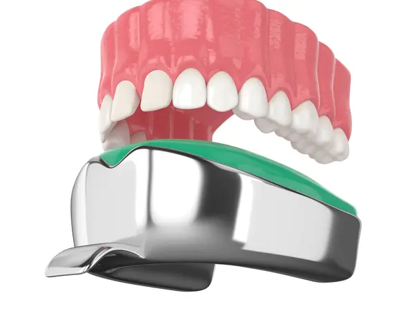Render Upper Jaw Dental Impression Tray White Background — Stock Photo, Image