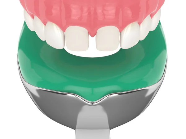 白底上牙印盘上颌骨3D成形术 免版税图库图片