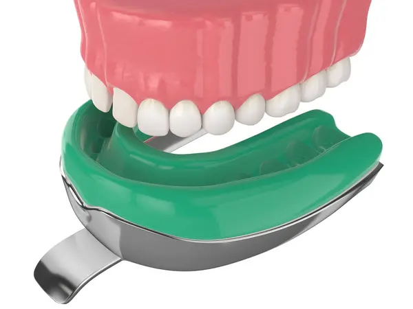 Vykreslení Horní Čelisti Otiskem Zubního Zásobníku Přes Bílé Pozadí Stock Snímky