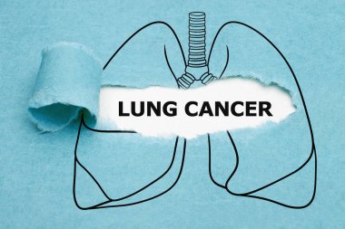 Text Lung Cancer appearing behind torn blue paper in drawn human lungs concept. clipart