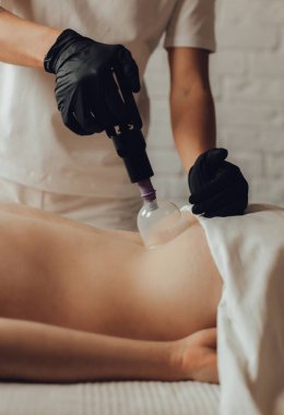 Masaj masasında yatan genç bir kadının sırtına masaj yapan kadın masörlerin elleri. Masöz, müşterinin fileto kasığına vakum fincanı uyguluyor. Fizik tedavi konsepti, boyun basınç noktası..