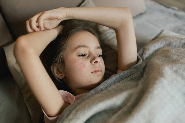 A sick child with skin rashes in bed. Child's skin with many red spot. Allergic reaction, Drug allergy, Scarlet fever, Atopic dermatitis, Diaper rash, Urticaria, Scabies, Heat rash. Part of a series.