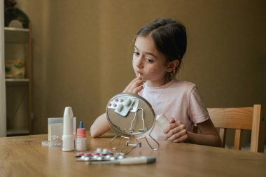 Yüzünde isilik olan genç bir kız aynanın önünde cildine krem sürüyor. Alerjik reaksiyon, ilaç alerjisi, kızamık, deri iltihabı, bez döküntüsü, ürtizi, uyuz. Bir serinin parçası.