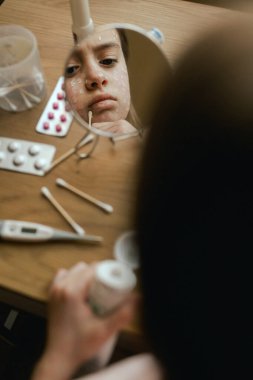 Yüzünde isilik olan genç bir kız aynanın önünde cildine krem sürüyor. Alerjik reaksiyon, ilaç alerjisi, kızamık, deri iltihabı, bez döküntüsü, ürtizi, uyuz. Bir serinin parçası.