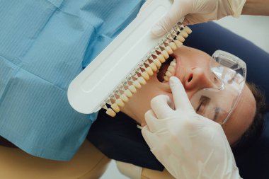 Genç bir dişçiye dişçi muayenesinde gülümseyen olgun bir kadın. Klinikte randevu. Diş beyazlatma, temizlik ya da oral, hastanede ağız ve sakız bakımı. Yumuşak odaklanma. Dizinin bir parçası. Yakın plan..