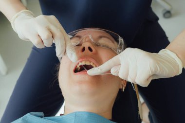 Genç bir dişçiye dişçi muayenesinde gülümseyen olgun bir kadın. Klinikte randevu. Diş beyazlatma, temizlik ya da oral, hastanede ağız ve sakız bakımı. Yumuşak odaklanma. Dizinin bir parçası. Yakın plan..