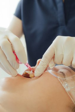 Genç bir dişçiye dişçi muayenesinde gülümseyen olgun bir kadın. Klinikte randevu. Diş beyazlatma, temizlik ya da oral, hastanede ağız ve sakız bakımı. Yumuşak odaklanma. Dizinin bir parçası. Yakın plan..