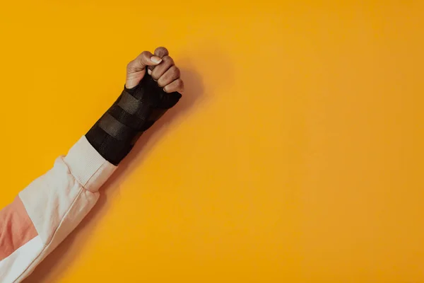Vereinzelt Verletzte Hand Eines Afro Mädchens Auf Gelbem Hintergrund Hochwertiges — Stockfoto