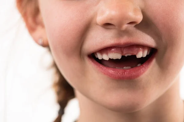 Portrait Little Girl White Background Healthy Developing Teeth High Quality — Stock Photo, Image