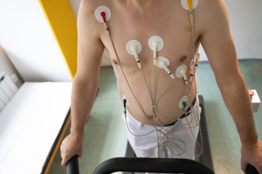 Orta yaşlı bir adam, klinik bir ortamda kalp izleme için EKG elektrotlarına bağlı bir koşu bandında tıbbi stres testinden geçiyor.. 