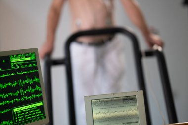 Orta yaşlı bir adam, klinik bir ortamda kalp izleme için EKG elektrotlarına bağlı bir koşu bandında tıbbi stres testinden geçiyor.. 