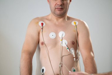 Orta yaşlı bir adam, klinik bir ortamda kalp izleme için EKG elektrotlarına bağlı bir koşu bandında tıbbi stres testinden geçiyor.. 