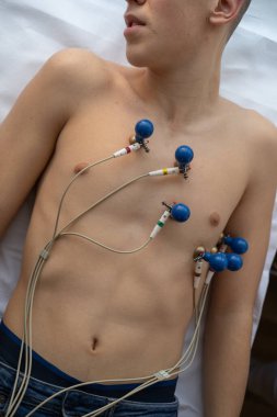 Kadın bir doktor, hastane odasında genç bir adama EKG çeker. Rutin bir kontrol sırasında kalp sağlığını dikkatle izler.