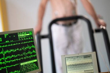 Orta yaşlı bir adam, klinik bir ortamda kalp izleme için EKG elektrotlarına bağlı bir koşu bandında tıbbi stres testinden geçiyor.. 