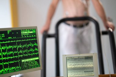 Orta yaşlı bir adam, klinik bir ortamda kalp izleme için EKG elektrotlarına bağlı bir koşu bandında tıbbi stres testinden geçiyor.. 