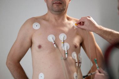 Orta yaşlı bir adam, klinik bir ortamda kalp izleme için EKG elektrotlarına bağlı bir koşu bandında tıbbi stres testinden geçiyor.. 