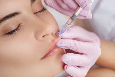 Doktor kozmetik uzmanı güzellik salonunda güzel bir kadının dudak büyütme prosedürünü yapıyor. Kozmetik cilt bakımı..