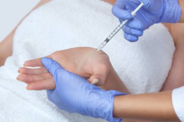 Doktor hiperhidroza karşı kadının avuçlarında kas içi botulinyum iğnesi yapıyor..