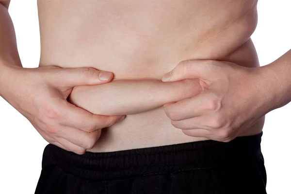 Толстяк Показывает Жировые Отложения Животе Снижение Избыточного Веса Лечения Ожирения — стоковое фото