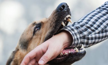 Bir Alman çoban köpeği bir adamı elinden ısırır. Yetiştirme ve eğitme safkan köpekler.