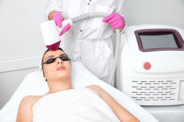 Elos epilasyon tüy çıkarma prosedürü bir kadının yüzünde. Güzellik uzmanı bir güzellik salonunda alnına lazer gençleştirme yapıyor. Yüz bakımı. Donanım ipl kozmetolojisi