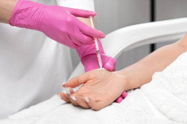 Kozmetik uzmanı bir kadının avuçlarında hiperhidroza karşı botulinyum toksini enjekte eder. Kadın kozmetolojisi, cilt bakımı.