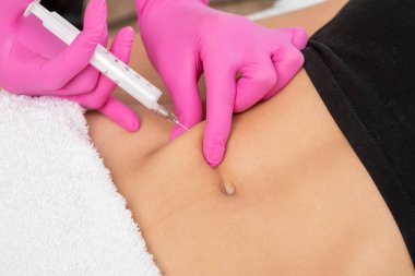 Estetik kozmetik doktoru kadın karnında ve vücudunda yağ yakmak için lipolitik enjeksiyon yapar. Güzellik salonunda kadın estetiği..