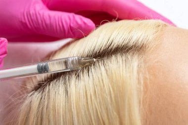 Kozmetik uzmanı, kuaförde saç dökülmesi ve kepek önleyici ilaç tedavisi uygular. Kozmetoloji kavramı.