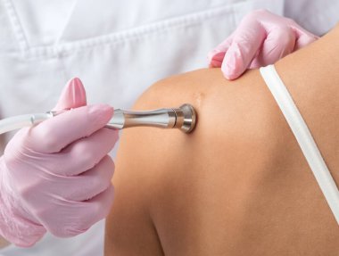 Güzellik uzmanımız bir güzellik salonunda omzundaki yara izini silmek için mikro cilt bakımı yapıyor. Kozmetoloji ve profesyonel cilt bakımı.