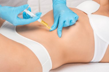 Kozmetik uzmanı bir kadının karnında ve belinde yağ yakmak için lipolitik enjeksiyon yapar. Güzellik salonunda kadın estetiği. Kozmetoloji konsepti..