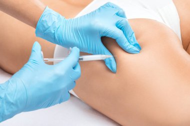 Bir kadının vücudunda epilasyon tüy çıkarma prosedürü. Güzellik uzmanı bir güzellik salonunda lazer gençleştirme yapıyor. İstenmeyen vücut kılları alınıyor. Donanım ipl kozmetolojisi