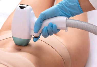 Bir kadının vücudunda epilasyon tüy çıkarma prosedürü. Güzellik uzmanı bir güzellik salonunda bacağının alt kısmında lazer gençleştirme yapıyor. İstenmeyen vücut kılları alınıyor. Donanım ipl kozmetolojisi