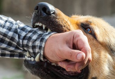 Erkek Alman kurdu bir adam tarafından el ısırıkları..