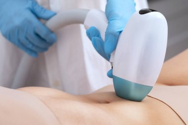 Bir kadının vücudunda epilasyon tüy çıkarma prosedürü. Güzellik uzmanı bir güzellik salonunda lazer gençleştirme yapıyor. İstenmeyen vücut kılları alınıyor. Donanım ipl kozmetolojisi