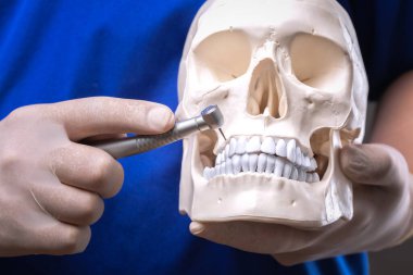 Diş ağrısının tedavisi. Doktor dişçi plastik bir insan kafatasını tutuyor ve dişlerini tedavi ediyor..