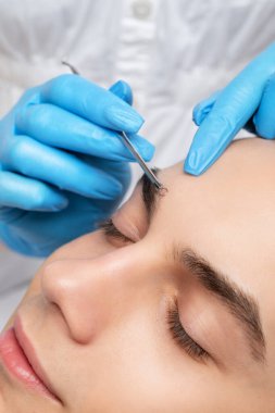 Yüzünde sorun olan genç bir adam. Sivilce tedavisi öncesi ve sonrası fotoğraflar.