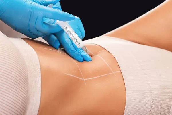 stock image Lipolytic injections for burning fat on the abdomen, legs and thighs of a woman. Women's aesthetic cosmetology in a beauty salon.