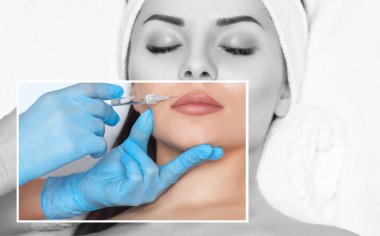 The doctor cosmetologist makes Lip augmentation procedure of a beautiful woman in a beauty salon.Cosmetology skin care. clipart