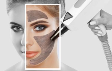 Carbon face peeling procedure in a beauty salon. Hardware cosmetology treatment. clipart