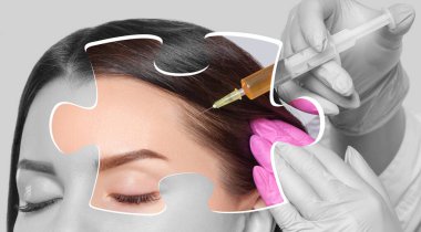 Cosmetologist does prp therapy against hair loss and anti-dandruff of a beautiful woman in a beauty salon. Cosmetology concept. clipart